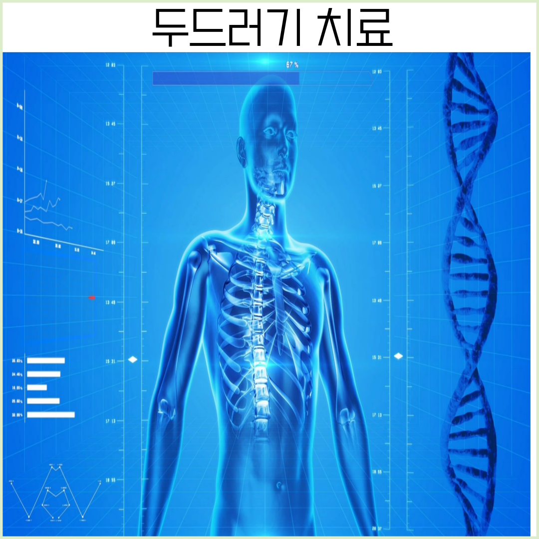 월배두드러기