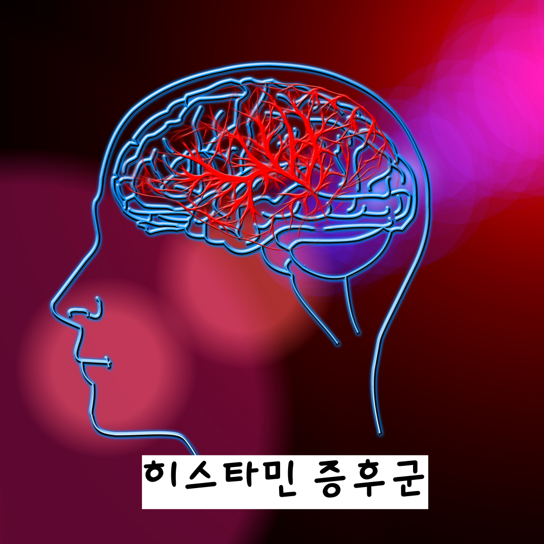 히스타민증후군, 만성염증한약, 달서구히스타민증후군