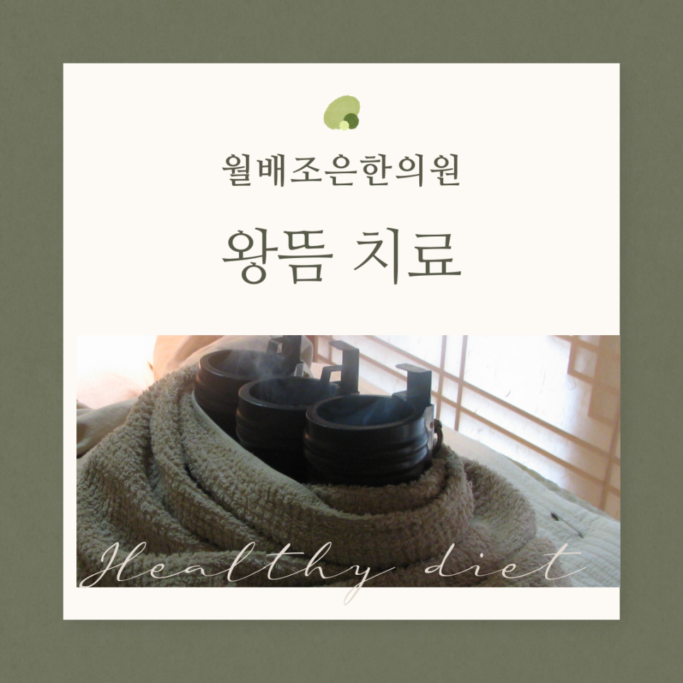 월배왕뜸,달서구왕뜸,뜸치료,월배뜸