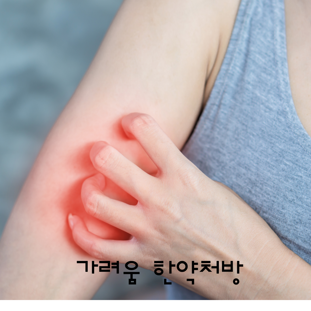 두드러기한약, 달서구두드러기, 월배두드러기, 두드러기소양감